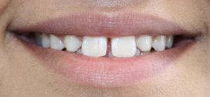 dentist newcastle | Honour Health