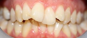 dentist newcastle | Honour Health