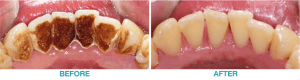 Airflow Newcastle | hygienist Newcastle | Honour Health
