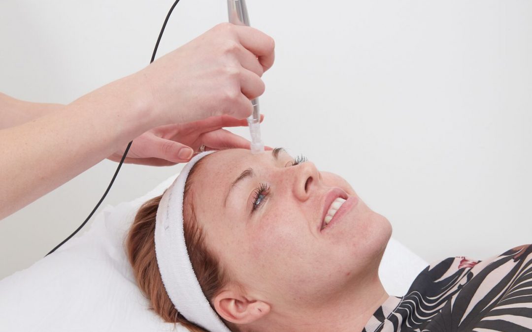 e-dermastamp micro needling treatment newcastle | Honour Health